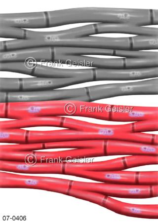 Herz, Herzmuskelgewebe bei Herzinfarkt