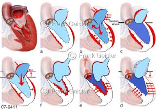 Herz, Phasen Herzpumpe Pumpfunktion mit Systole und Diastole