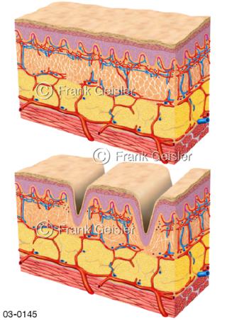 Hautschichten mit Bindegewebe und Hautfalten
