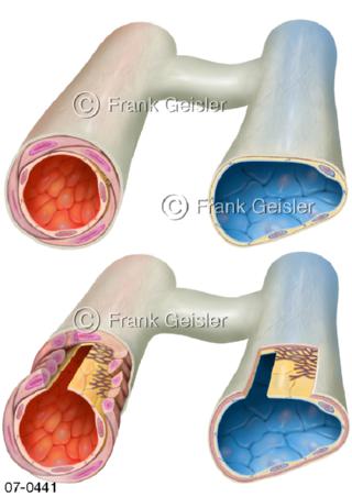 Blutgefäße Arterie Vene und Arteriole Venole