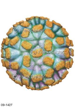 Norwalk-Virus Norovirus Magen-Darm-Erkrankung