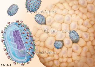 Virus-Therapie Immuno-Virotherapie mit Masernvirus bei Brustkrebs und Darmkrebs