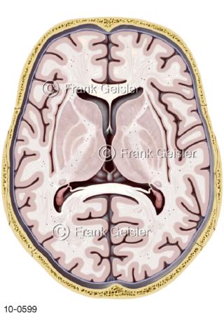Gehirn, Hirnschnitt Horizontalschnitt Schädelgrube