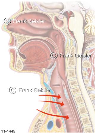 Notfall, Zugangswege Kehlkopf Luftröhre