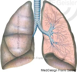 Ansicht der Lunge mit Luftröhre Trachea, Frontalschnitt linke Lunge