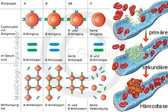 Blutgruppen A, B, AB und 0 mit Antikörper; Blutgerinnung