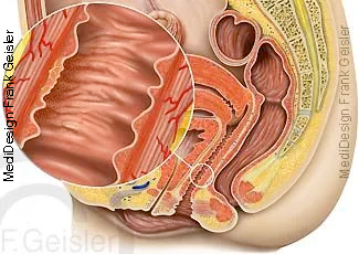 Gräfenberg-Zone, G-Punkt, eine erogene Zone der Vagina