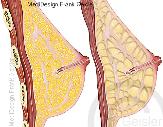 Schnitt durch Brustdrüse, Darstellungen Gewebe der Mamma Schnitt durch Brustdrüse, Darstellungen Gewebe der Mamma