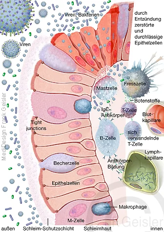 Immunreaktion der Schleimhaut, schleimhautassoziiertes lymphatisches Gewebe im Darm