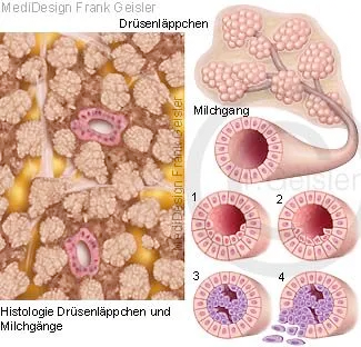 Drüsengewebe der Brustdrüse mit Milchgang